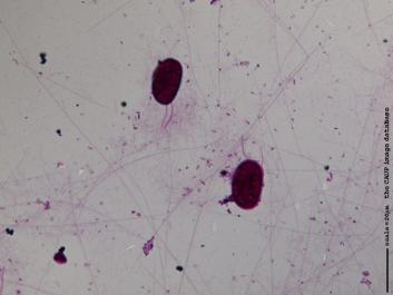 M003 100x.JPG